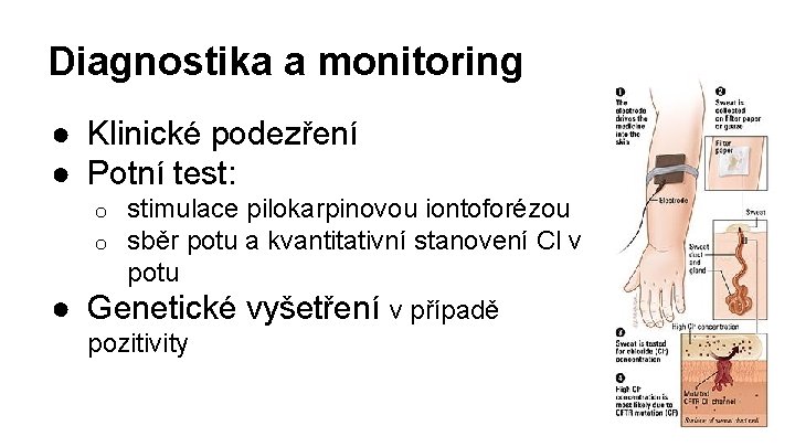 Diagnostika a monitoring ● Klinické podezření ● Potní test: stimulace pilokarpinovou iontoforézou sběr potu