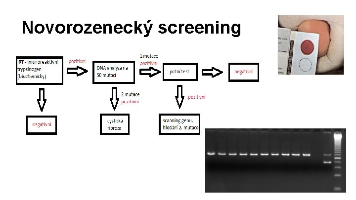 Novorozenecký screening 