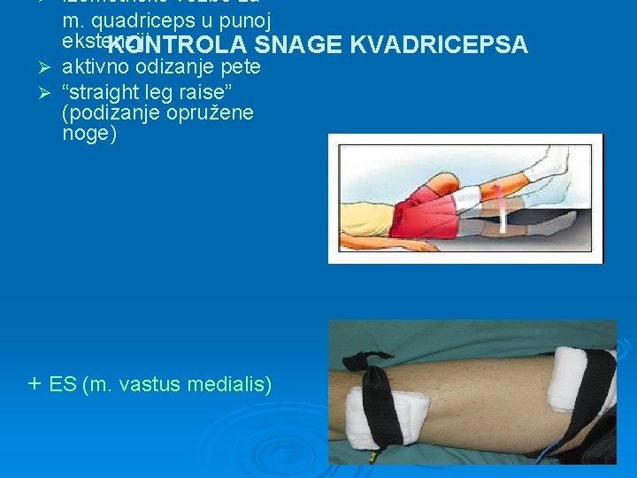 izometričke vežbe za m. quadriceps u punoj ekstenziji KONTROLA SNAGE KVADRICEPSA Ø aktivno odizanje