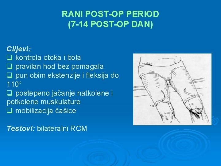 RANI POST-OP PERIOD (7 -14 POST-OP DAN) Ciljevi: q kontrola otoka i bola q