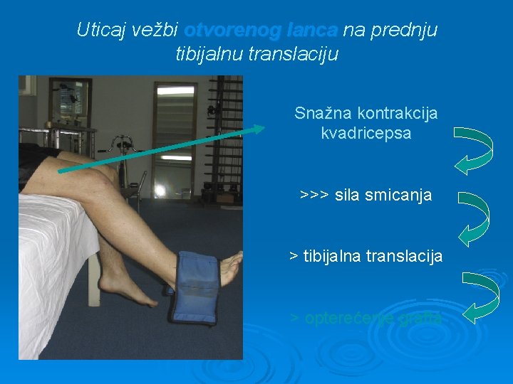 Uticaj vežbi otvorenog lanca na prednju tibijalnu translaciju Snažna kontrakcija kvadricepsa >>> sila smicanja