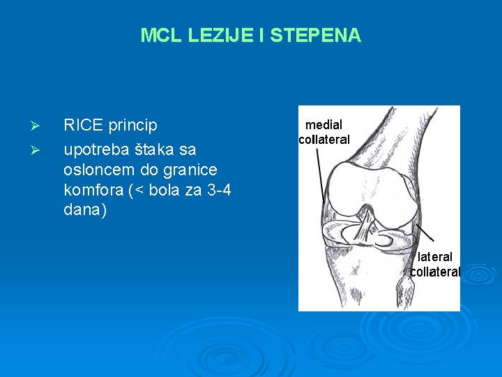 MCL LEZIJE I STEPENA Ø Ø RICE princip upotreba štaka sa osloncem do granice