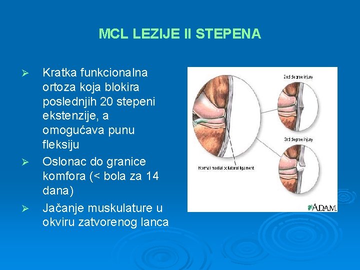 MCL LEZIJE II STEPENA Ø Ø Ø Kratka funkcionalna ortoza koja blokira poslednjih 20