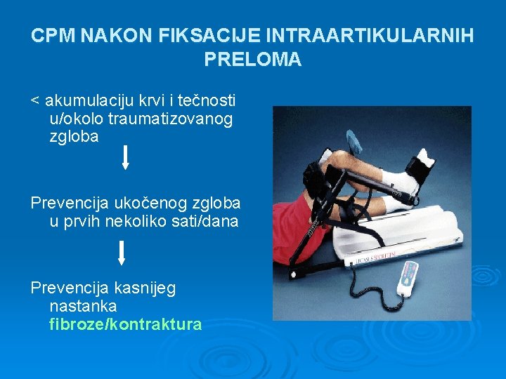 CPM NAKON FIKSACIJE INTRAARTIKULARNIH PRELOMA < akumulaciju krvi i tečnosti u/okolo traumatizovanog zgloba Prevencija