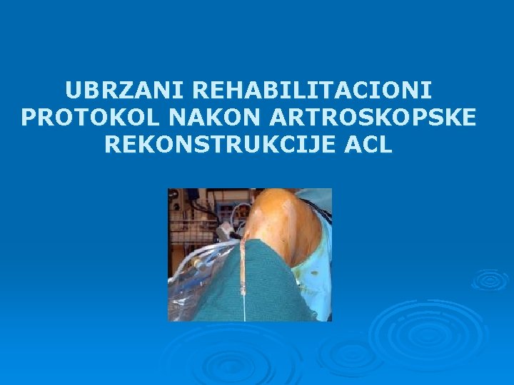 UBRZANI REHABILITACIONI PROTOKOL NAKON ARTROSKOPSKE REKONSTRUKCIJE ACL 