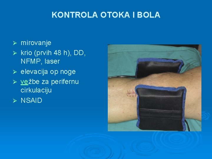 KONTROLA OTOKA I BOLA Ø Ø Ø mirovanje krio (prvih 48 h), DD, NFMP,