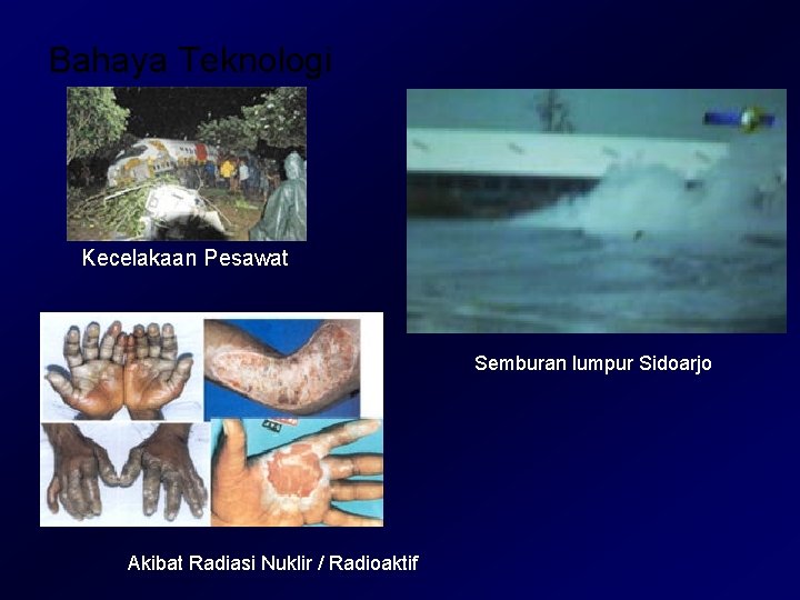 Bahaya Teknologi Kecelakaan Pesawat Semburan lumpur Sidoarjo Akibat Radiasi Nuklir / Radioaktif Bahaya Teknologi Kecelakaan Pesawat Semburan lumpur Sidoarjo Akibat Radiasi Nuklir / Radioaktif