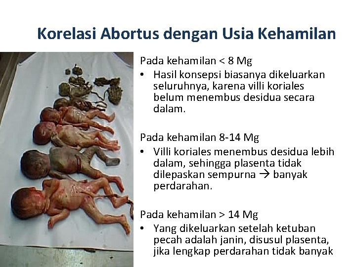 Korelasi Abortus dengan Usia Kehamilan Pada kehamilan < 8 Mg • Hasil konsepsi biasanya