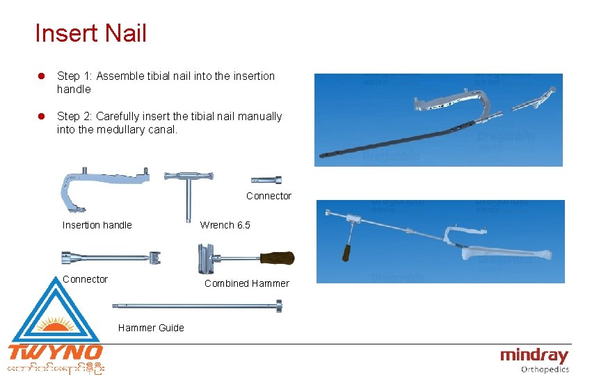 Insert Nail l Step 1: Assemble tibial nail into the insertion handle l Step