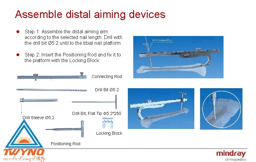Assemble distal aiming devices l Step 1: Assemble the distal aiming arm according to