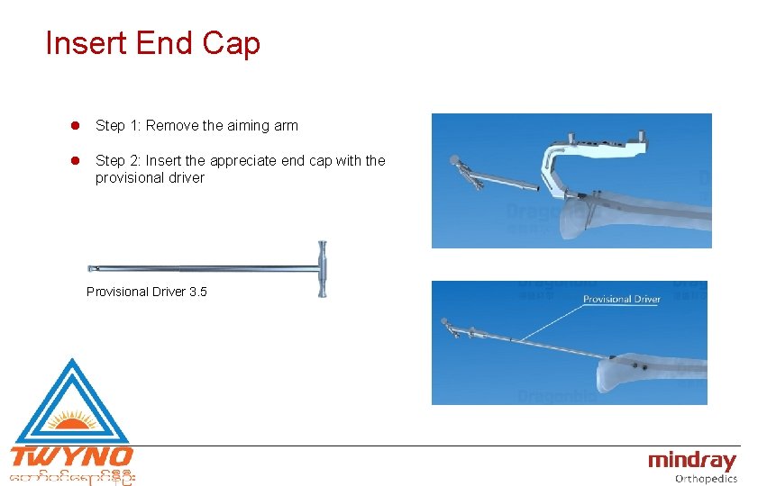 Insert End Cap l Step 1: Remove the aiming arm l Step 2: Insert