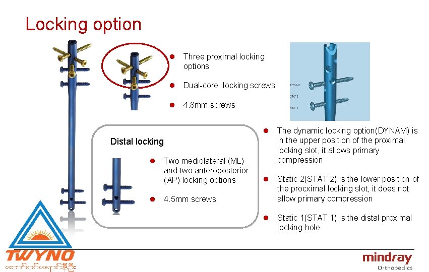 Locking option l Three proximal locking options l Dual-core locking screws l 4. 8