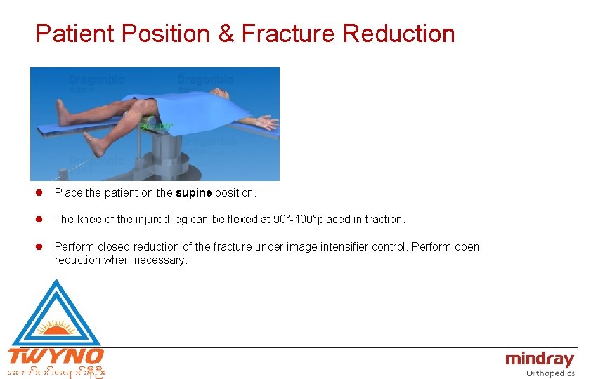 Patient Position & Fracture Reduction l Place the patient on the supine position. l