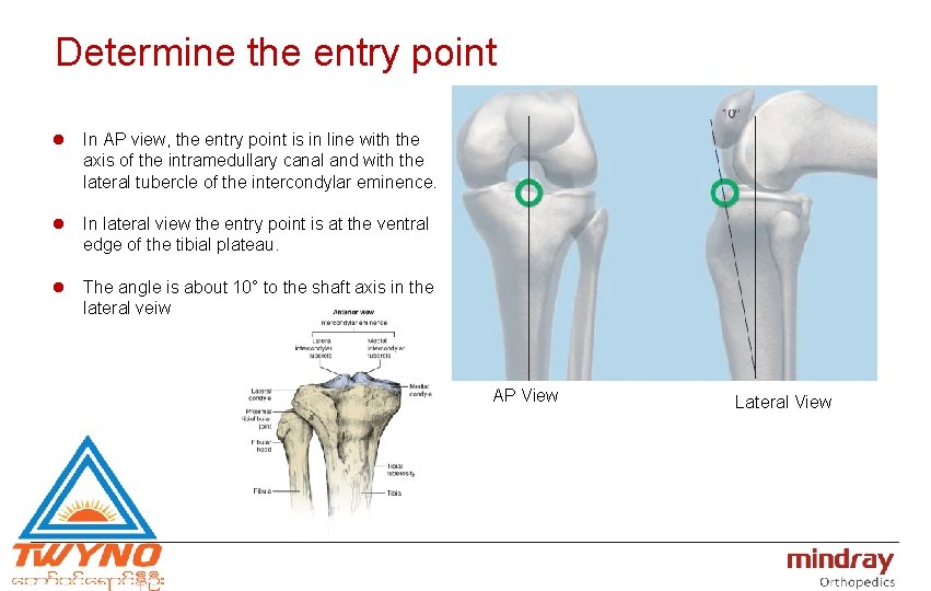 Determine the entry point l In AP view, the entry point is in line