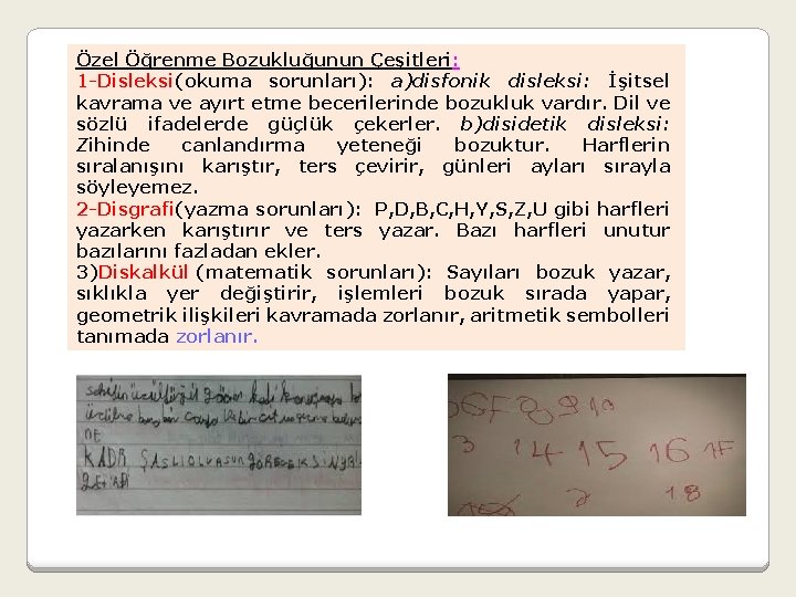 Özel Öğrenme Bozukluğunun Çeşitleri: 1 -Disleksi(okuma sorunları): a)disfonik disleksi: İşitsel kavrama ve ayırt etme