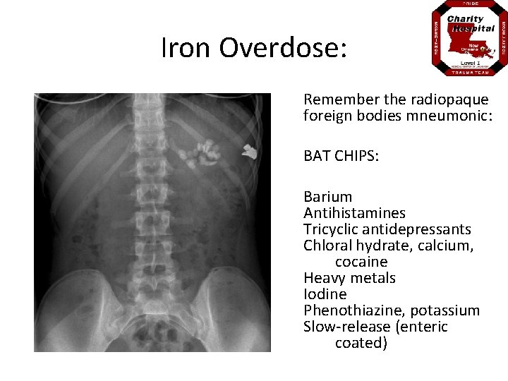 Iron Overdose: Remember the radiopaque foreign bodies mneumonic: BAT CHIPS: Barium Antihistamines Tricyclic antidepressants