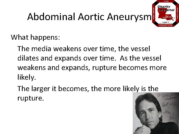 Abdominal Aortic Aneurysm What happens: The media weakens over time, the vessel dilates and