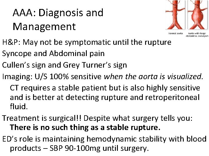 AAA: Diagnosis and Management H&P: May not be symptomatic until the rupture Syncope and