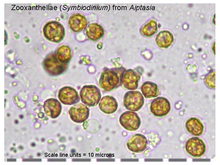 Zooxanthellae (Symbiodinium) from Aiptasia Scale line units = 10 microns 