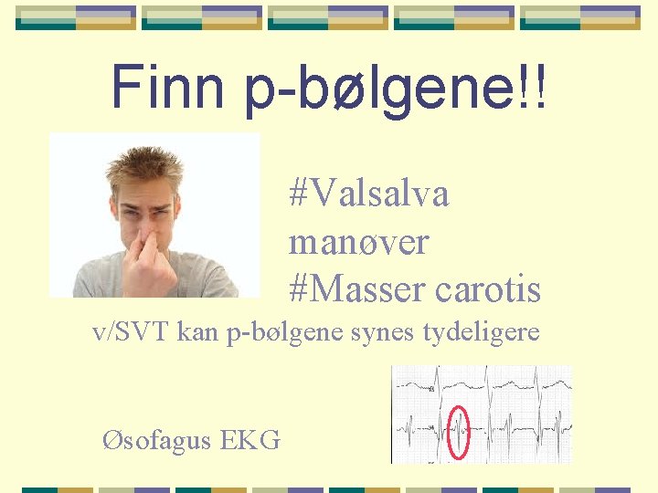 Finn p-bølgene!! #Valsalva manøver #Masser carotis v/SVT kan p-bølgene synes tydeligere Øsofagus EKG 