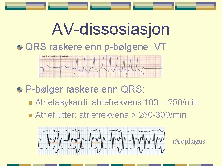 AV-dissosiasjon QRS raskere enn p-bølgene: VT P-bølger raskere enn QRS: Atrietakykardi: atriefrekvens 100 –