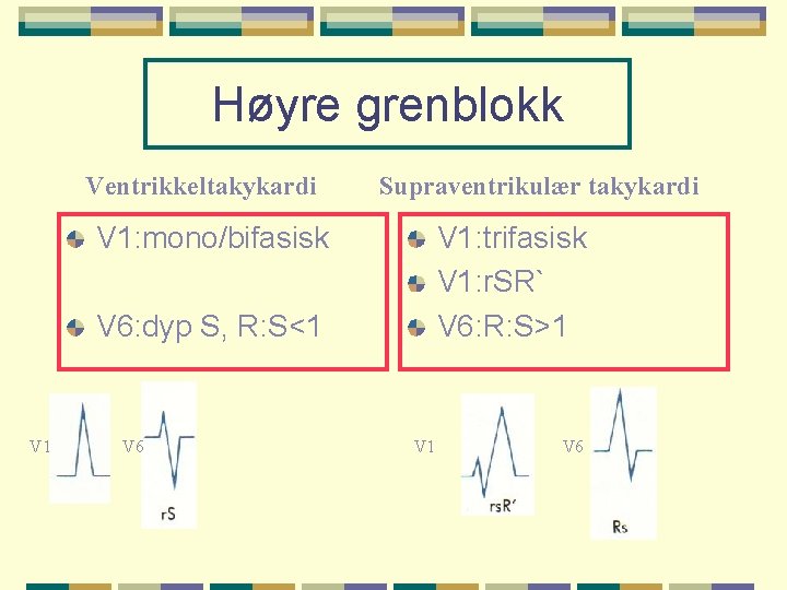 Høyre grenblokk Ventrikkeltakykardi Supraventrikulær takykardi V 1: mono/bifasisk V 1: trifasisk V 1: r.