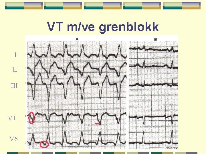 VT m/ve grenblokk I II III V 1 V 6 