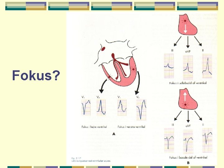 Fokus? 