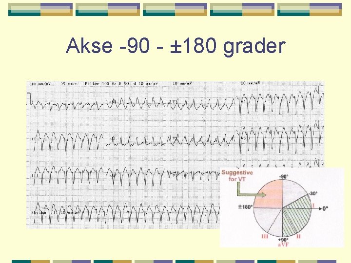 Akse -90 - ± 180 grader 