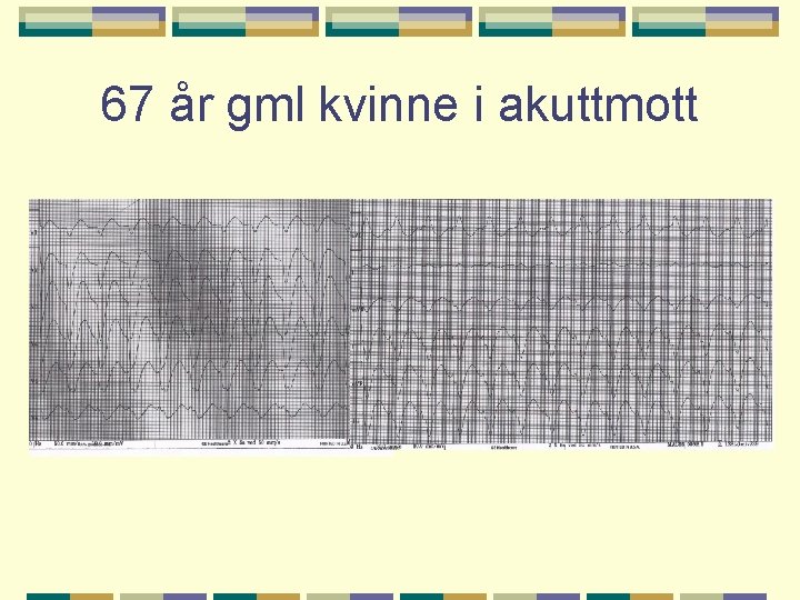 67 år gml kvinne i akuttmott 