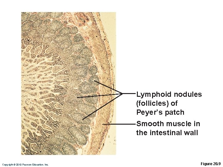 Lymphoid nodules (follicles) of Peyer’s patch Smooth muscle in the intestinal wall Copyright ©