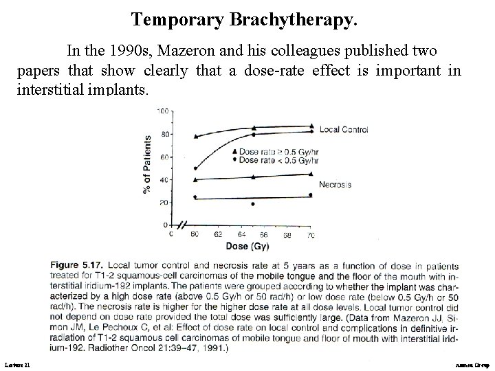 Temporary Brachytherapy. In the 1990 s, Mazeron and his colleagues published two papers that