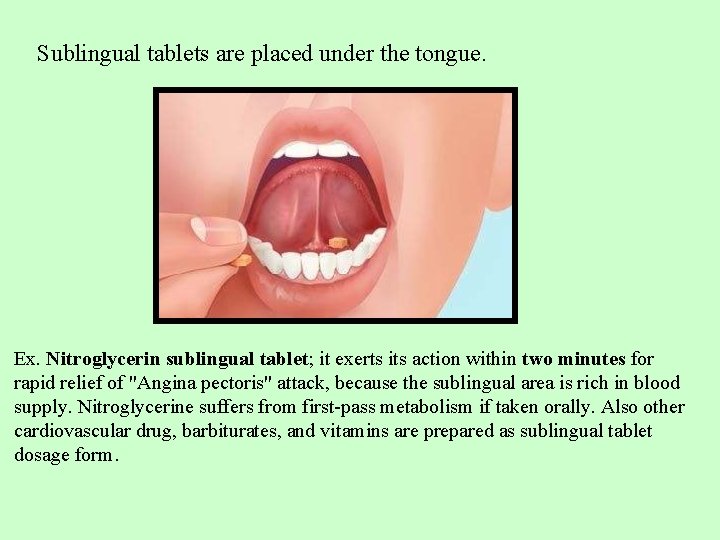 Sublingual tablets are placed under the tongue. Ex. Nitroglycerin sublingual tablet; it exerts its