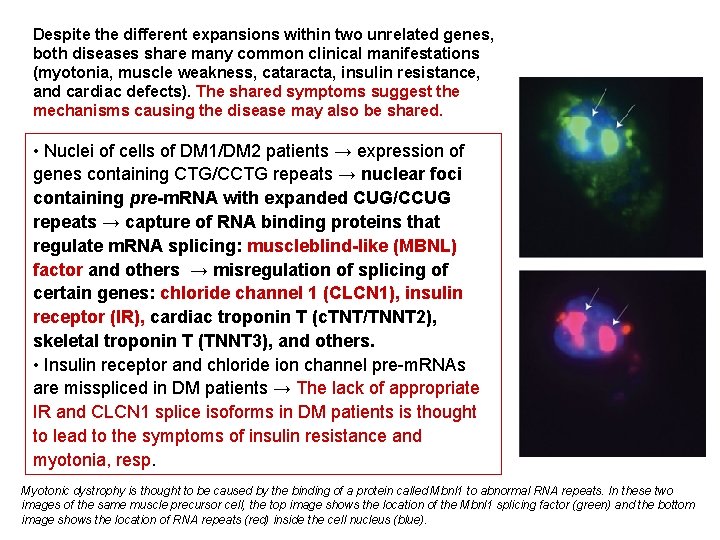 Despite the different expansions within two unrelated genes, both diseases share many common clinical