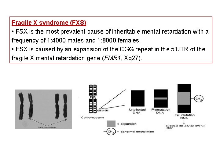 Fragile X syndrome (FXS) • FSX is the most prevalent cause of inheritable mental