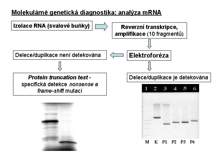 Molekulárně genetická diagnostika: analýza m. RNA Izolace RNA (svalové buňky) Delece/duplikace není detekována Protein