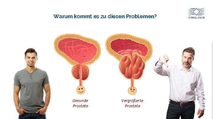 Warum kommt es zu diesen Problemen? Gesunde Prostata www. coral-club. com Vergrößerte Prostata 