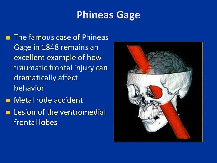 Phineas Gage n n n The famous case of Phineas Gage in 1848 remains