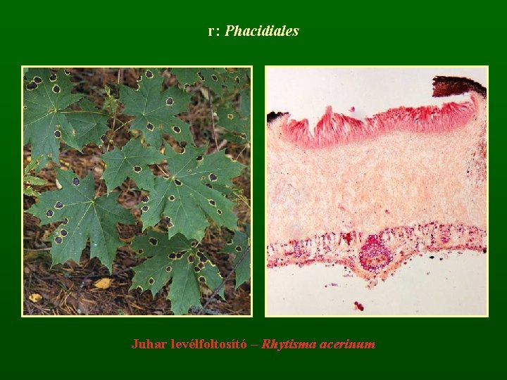 r: Phacidiales Juhar levélfoltosító – Rhytisma acerinum 