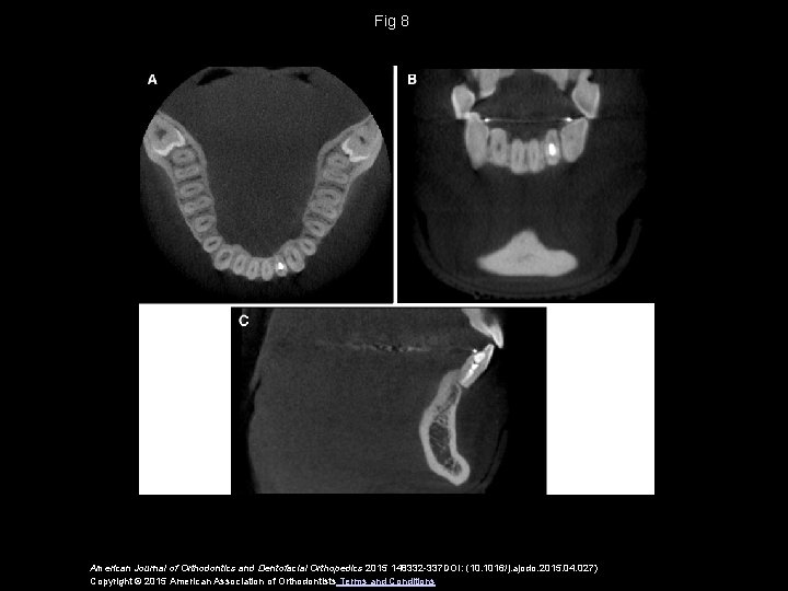 Fig 8 American Journal of Orthodontics and Dentofacial Orthopedics 2015 148332 -337 DOI: (10.