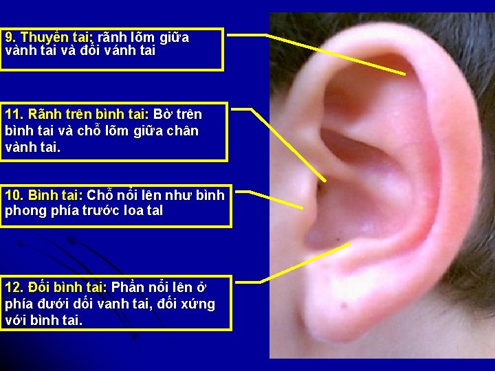 9. Thuyền tai: rãnh lõm giữa vành tai và đối vánh tai 11. Rãnh