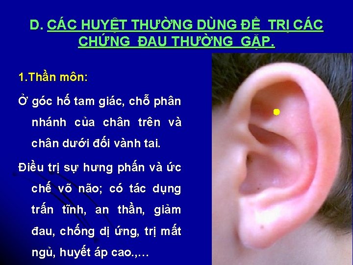 D. CÁC HUYỆT THƯỜNG DÙNG ĐỂ TRỊ CÁC CHỨNG ĐAU THƯỜNG GẶP. 1. Thần