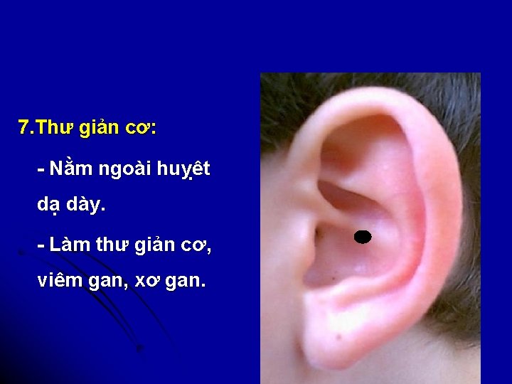 7. Thư giản cơ: - Nằm ngoài huỵêt dạ dày. - Làm thư giản