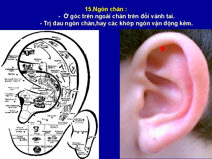 15. Ngón chân : - Ở góc trên ngoài chân trên đối vành tai.