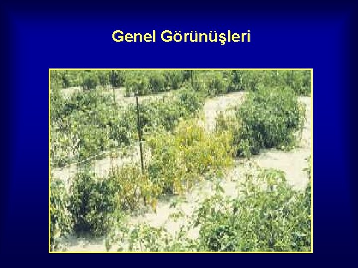 Genel Görünüşleri 