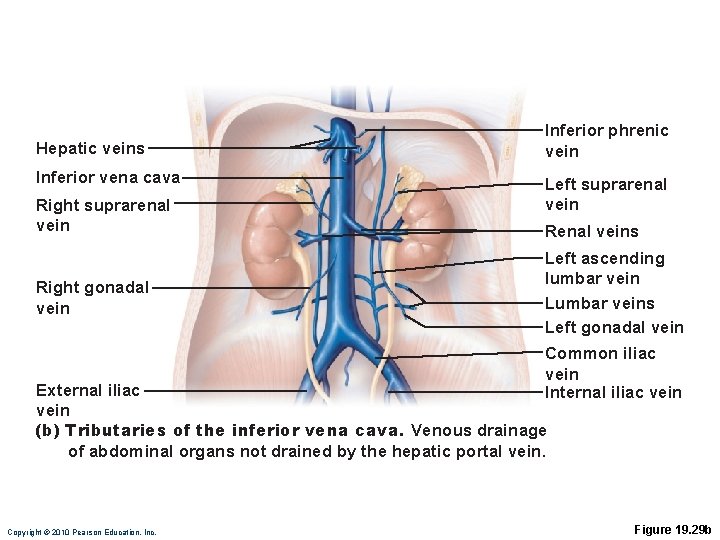 Hepatic veins Inferior vena cava Right suprarenal vein Right gonadal vein Inferior phrenic vein