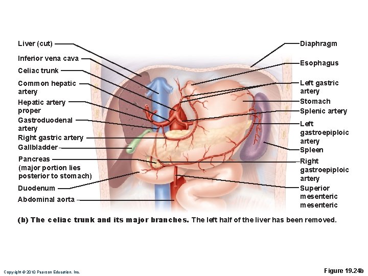 Liver (cut) Inferior vena cava Celiac trunk Diaphragm Esophagus Common hepatic artery Hepatic artery