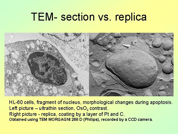 TEM- section vs. replica HL-60 cells, fragment of nucleus, morphological changes during apoptosis. Left
