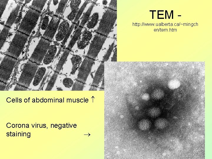 TEM http: //www. ualberta. ca/~mingch en/tem. htm Cells of abdominal muscle Corona virus, negative