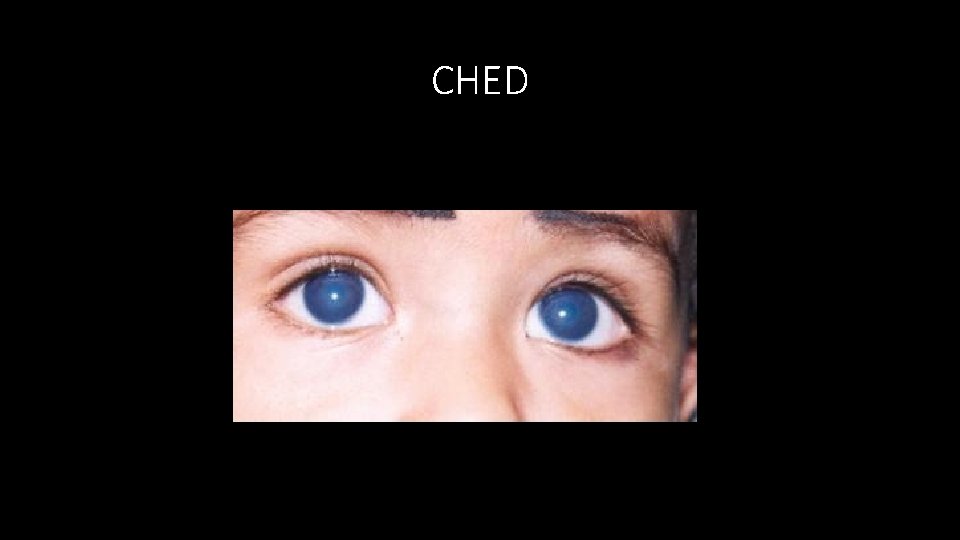 CHED 